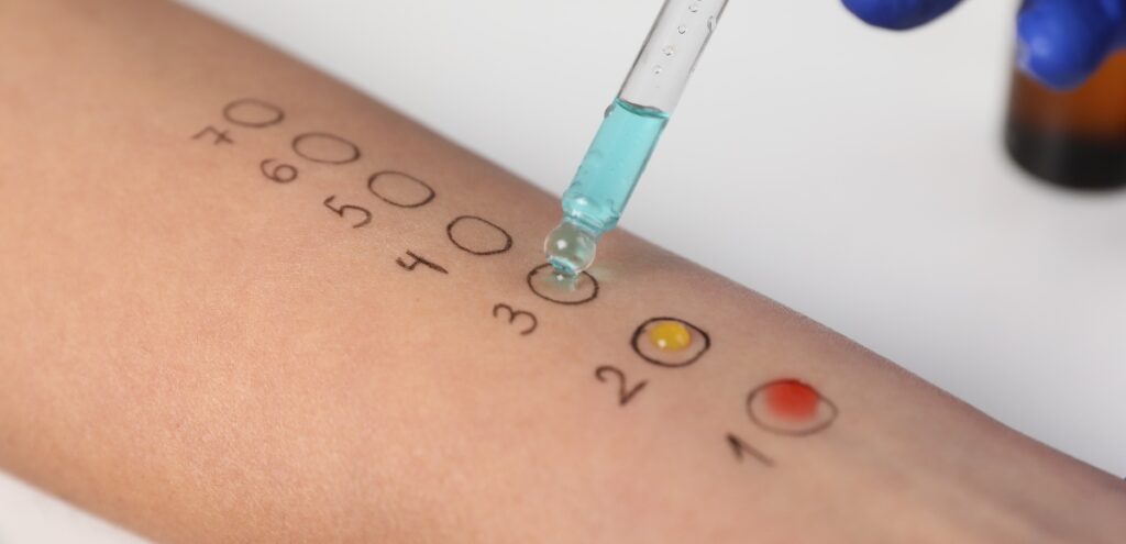 prick test
