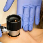 visita dermatologica santagostino garbatella