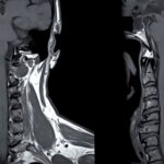 risonanza magnetica cervicale garbatella