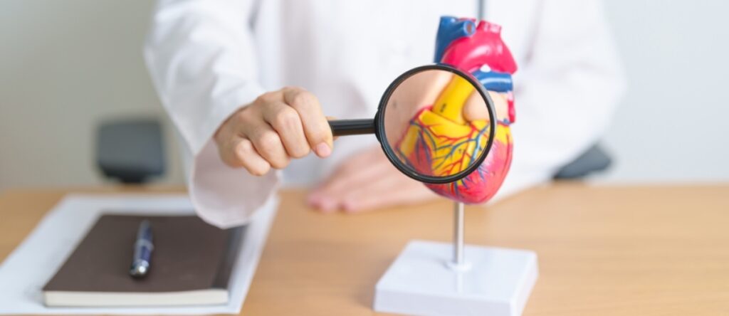 aterosclerosi santagostino garbatella