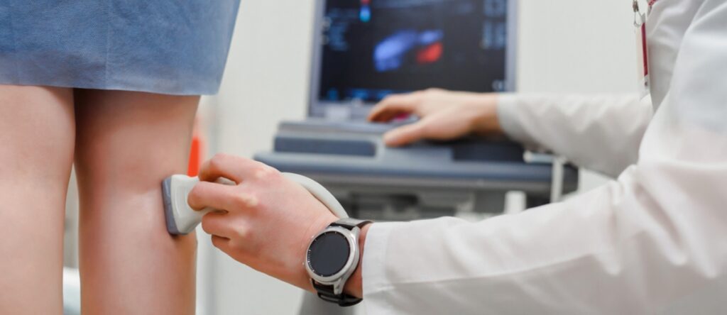 trombosi venosa profonda santagostino garbatella