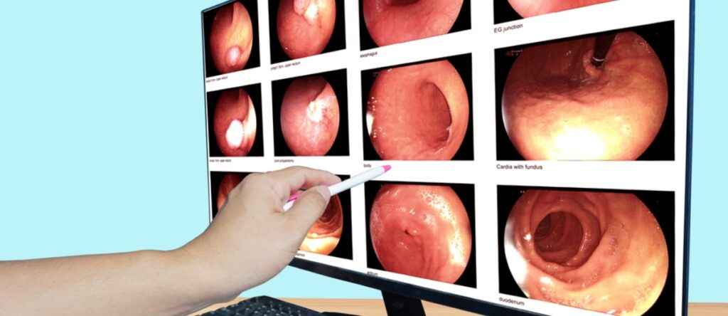 fibroscopia santagostino garbatella