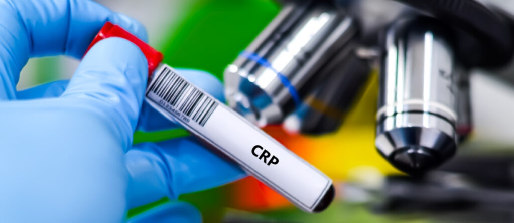 PCR santagostino garbatella