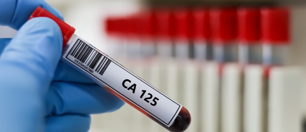 ca125 santagostino garbatella