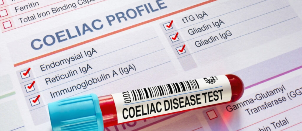 esami celiachia santagostino garbatella