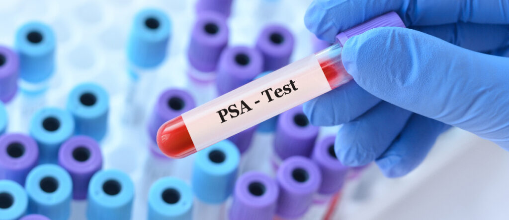 psa santagostino garbatella