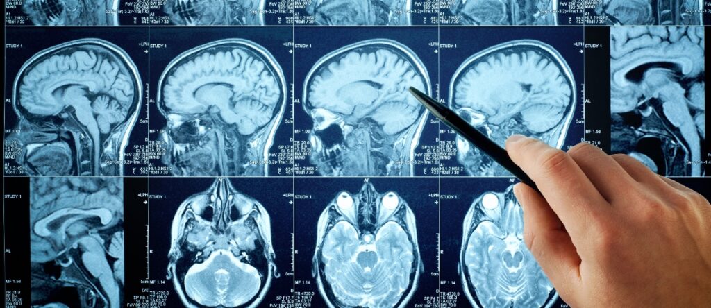 risonanza magnetica encefalo santagostino garbatella