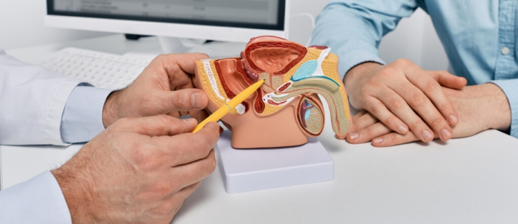 ipertrofia prostatica benigna santagostino garbatella