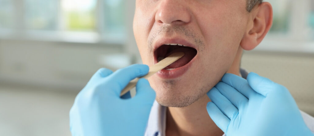 calcoli salivari garbatella