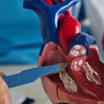 visita cardiochirurgica